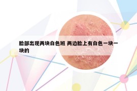 臉部出現(xiàn)兩塊白色班 兩邊臉上有白色一塊一塊的
