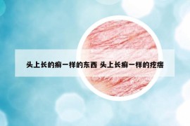 頭上長的癬一樣的東西 頭上長癬一樣的疙瘩