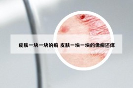 皮膚一塊一塊的癬 皮膚一塊一塊的像癬還癢