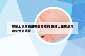 腳腕上銀屑病用哪些外用藥 腳腕上銀屑病用哪些外用藥膏