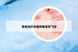 貴陽治療白癜風(fēng)哪家好飛華