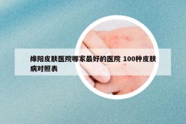 綿陽皮膚醫(yī)院哪家最好的醫(yī)院 100種皮膚病對照表
