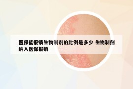 醫(yī)保能報銷生物制劑的比例是多少 生物制劑納入醫(yī)保報銷