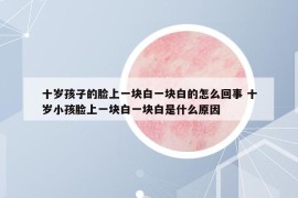 十歲孩子的臉上一塊白一塊白的怎么回事 十歲小孩臉上一塊白一塊白是什么原因