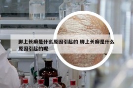 腳上長癬是什么原因引起的 腳上長癬是什么原因引起的呢