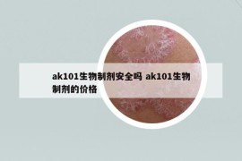 ak101生物制劑安全嗎 ak101生物制劑的價(jià)格