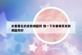 長(zhǎng)春著名的皮膚病醫(yī)院 搜一下長(zhǎng)春哪家皮膚病醫(yī)院好
