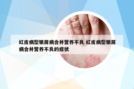 紅皮病型銀屑病合并營養(yǎng)不良 紅皮病型銀屑病合并營養(yǎng)不良的癥狀