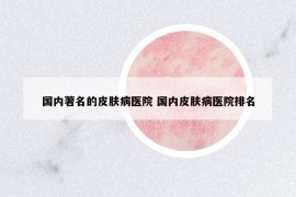 國內(nèi)著名的皮膚病醫(yī)院 國內(nèi)皮膚病醫(yī)院排名