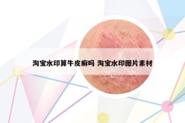 淘寶水印算牛皮癬嗎 淘寶水印圖片素材