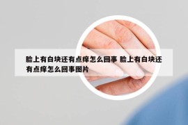臉上有白塊還有點(diǎn)癢怎么回事 臉上有白塊還有點(diǎn)癢怎么回事圖片