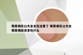 銀屑病忌口大全全在這里了 銀屑病忌口大全銀屑病應(yīng)該多吃什么