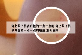 背上長了很多白色的一點(diǎn)一點(diǎn)的 背上長了很多白色的一點(diǎn)一點(diǎn)的痘痘,怎么消除