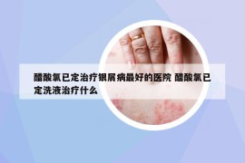 醋酸氯已定治療銀屑病最好的醫(yī)院 醋酸氯已定洗液治療什么