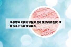 成都市草食街哪家醫(yī)院是看皮膚病的醫(yī)院 成都市草市街皮膚病醫(yī)院