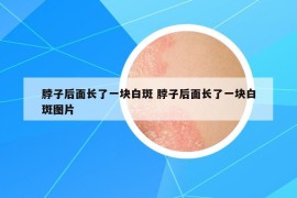 脖子后面長了一塊白斑 脖子后面長了一塊白斑圖片