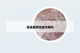 南昌醫(yī)院檢查白癜風(fēng)