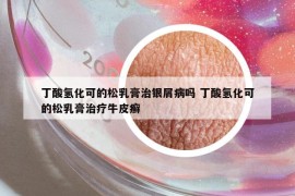 丁酸氫化可的松乳膏治銀屑病嗎 丁酸氫化可的松乳膏治療牛皮癬
