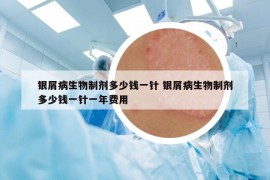 銀屑病生物制劑多少錢一針 銀屑病生物制劑多少錢一針一年費(fèi)用