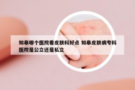如皋哪個(gè)醫(yī)院看皮膚科好點(diǎn) 如皋皮膚病專(zhuān)科醫(yī)院是公立還是私立