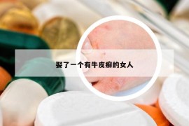 娶了一個有牛皮癬的女人