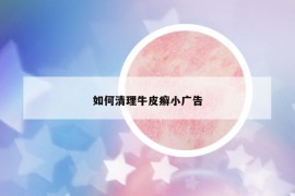 如何清理牛皮癬小廣告