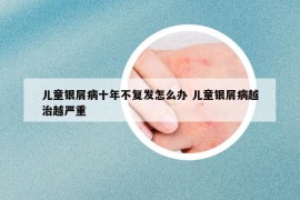 兒童銀屑病十年不復發(fā)怎么辦 兒童銀屑病越治越嚴重