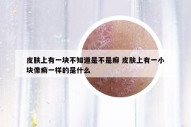 皮膚上有一塊不知道是不是癬 皮膚上有一小塊像癬一樣的是什么