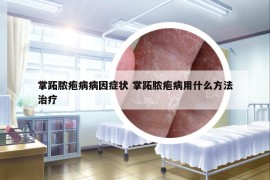 掌跖膿皰病病因癥狀 掌跖膿皰病用什么方法治療