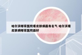 哈爾濱哪家醫(yī)院看皮膚病最有名氣 哈爾濱看皮膚病哪家醫(yī)院最好