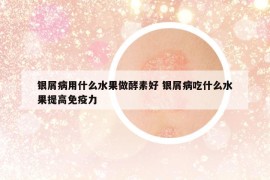 銀屑病用什么水果做酵素好 銀屑病吃什么水果提高免疫力