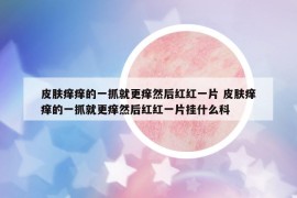 皮膚癢癢的一抓就更癢然后紅紅一片 皮膚癢癢的一抓就更癢然后紅紅一片掛什么科