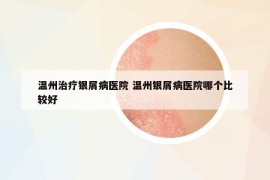 溫州治療銀屑病醫(yī)院 溫州銀屑病醫(yī)院哪個比較好