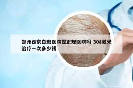 鄭州西京白斑醫(yī)院是正規(guī)醫(yī)院嗎 308激光治療一次多少錢