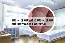 窄譜uvb紫外線治療儀 窄譜uvb紫外線治療儀治療白點(diǎn)風(fēng)多長(zhǎng)時(shí)間一次