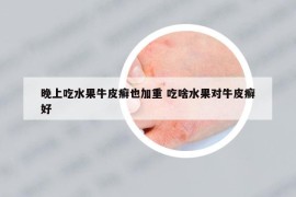 晚上吃水果牛皮癬也加重 吃啥水果對牛皮癬好