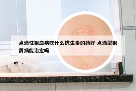 點滴性銀血病吃什么抗生素的藥好 點滴型銀屑病能治愈嗎