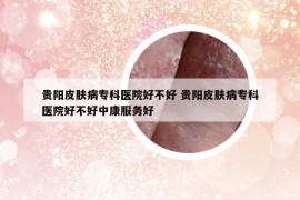 貴陽皮膚病?？漆t(yī)院好不好 貴陽皮膚病專科醫(yī)院好不好中康服務(wù)好