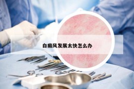 白癜風(fēng)發(fā)展太快怎么辦
