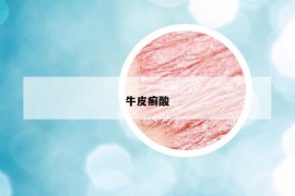 牛皮癬酸