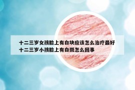 十二三歲女孩臉上有白塊應(yīng)該怎么治療最好 十二三歲小孩臉上有白斑怎么回事