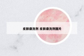 皮膚康洗劑 皮膚康洗劑圖片