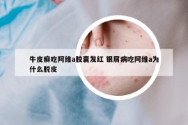 牛皮癬吃阿維a膠囊發(fā)紅 銀屑病吃阿維a為什么脫皮