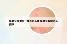 胳膊彎癢像癬一樣點怎么辦 胳膊彎長癬怎么回事