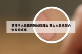 男孩子大腿根兩側(cè)長蘚用治 男士大腿根部?jī)?nèi)側(cè)長癬疼癢