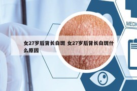 女27歲后背長白斑 女27歲后背長白斑什么原因
