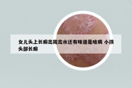 女兒頭上長癬出隴出水還有味道是啥病 小孩頭部長癬