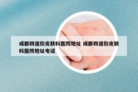 成都四道街皮膚科醫(yī)院地址 成都四道街皮膚科醫(yī)院地址電話