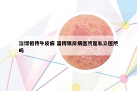 淄博祖?zhèn)髋Ｆぐ_ 淄博銀屑病醫(yī)院是私立醫(yī)院嗎
