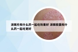 消銀片和什么藥一起吃效果好 消銀膠囊和什么藥一起吃更好
